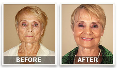 The Fountain Of Youth - In A Jar?