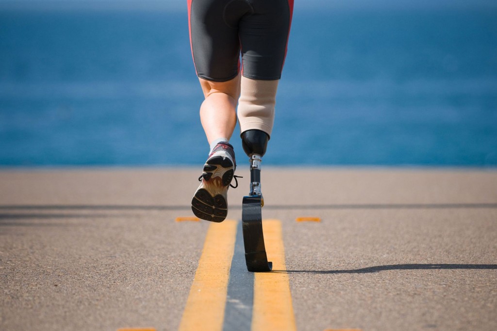 Prosthetic Limbs Helping You Regain Your Lost Strength